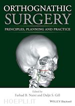 naini f - orthognathic surgery – principles, planning and practice