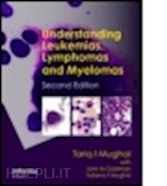 mughal tariq i. - understanding leukemias, lymphomas and myelomas