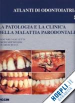valletta giancarlo-matarasso sergio-bucci eduardo - patologia e clinica della malattia parodontale