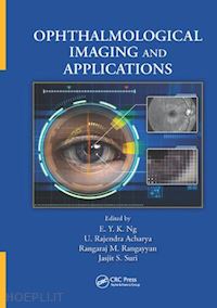 ng e. y. k. (curatore); acharya u. rajendra (curatore); rangayyan rangaraj m. (curatore); suri jasjit s. (curatore) - ophthalmological imaging and applications