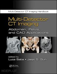 saba luca (curatore); suri jasjit s. (curatore) - multi-detector ct imaging