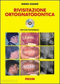 gianni' ennio - rivisitazione ortognatodontica. con dvd