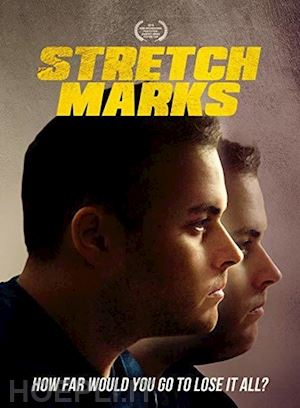  - stretch marks [edizione: stati uniti]