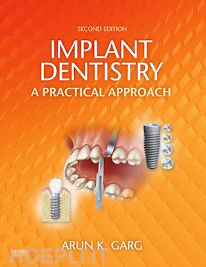 arun k. garg - implant dentistry - e-book