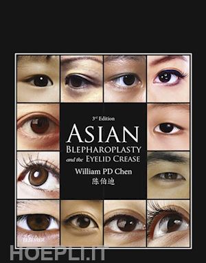 william p. chen - asian blepharoplasty and the eyelid crease e-book