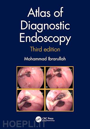 ibrarullah mohammad - atlas of diagnostic endoscopy, 3e