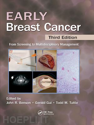 benson john r (curatore); gui gerald p.h. (curatore); tuttle todd (curatore) - early breast cancer