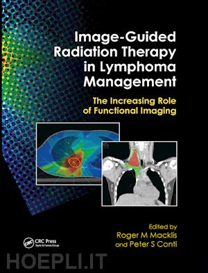 macklis roger m. (curatore); conti peter s. (curatore) - image-guided radiation therapy in lymphoma management