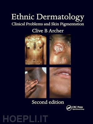 archer clive b. (curatore) - ethnic dermatology