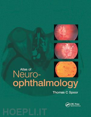 spoor thomas c. - atlas of neuro-ophthalmology