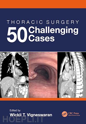 vigneswaran wickii (curatore) - thoracic surgery: 50 challenging cases