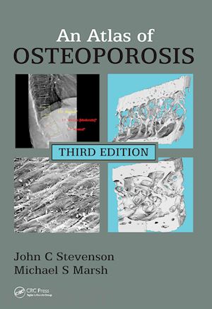 stevenson john c.; marsh michael s. - an atlas of osteoporosis