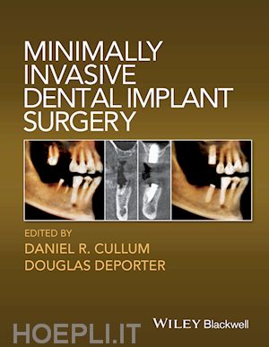 cullum d - minimally invasive dental implant surgery