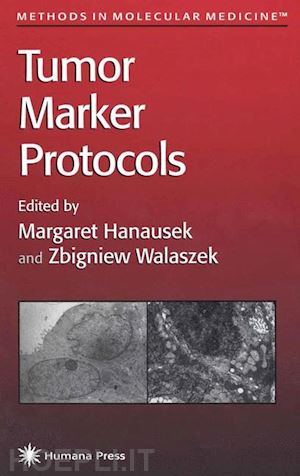 hanausek margaret (curatore); walaszek zbigniew (curatore) - tumor marker protocols