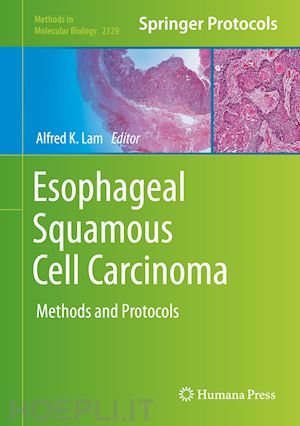 lam alfred k. (curatore) - esophageal squamous cell carcinoma