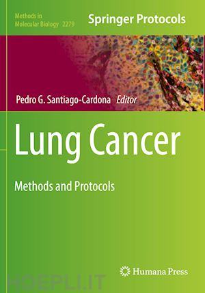 santiago-cardona pedro g. (curatore) - lung cancer