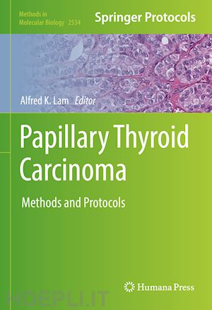 lam alfred k. (curatore) - papillary thyroid carcinoma