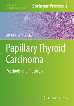 lam alfred k. (curatore) - papillary thyroid carcinoma