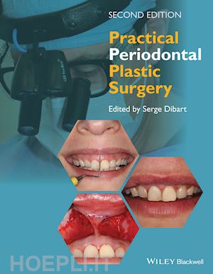 dibart s - practical periodontal plastic surgery 2e