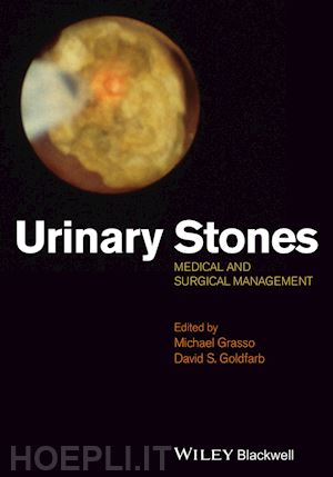 grasso m - urinary stones – medical and surgical management