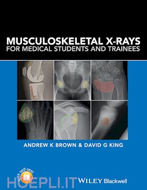 brown ak - musculoskeletal x–rays for medical students