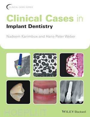 karimbux nadeem (curatore); weber hans–peter (curatore) - clinical cases in implant dentistry
