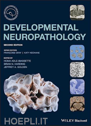 adle–biassette h - developmental neuropathology