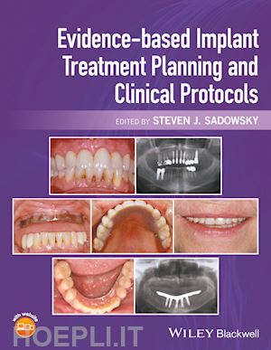 sadowsky sj - evidence–based implant treatment planning and clinical protocols