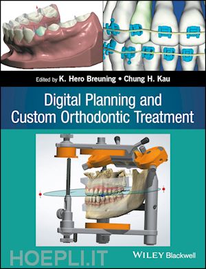 breuning kh - digital planning and custom orthodontic treatment