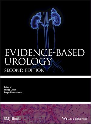 dahm p - evidence–based urology 2e