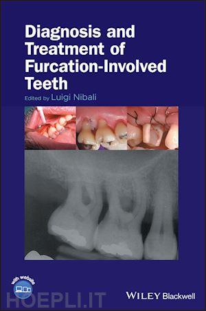 nibali l - diagnosis and treatment of furcation–involved teeth