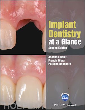 malet p - implant dentistry at a glance, 2nd edition