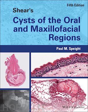 speight paul - shear's cysts of the oral and maxillofacial regions