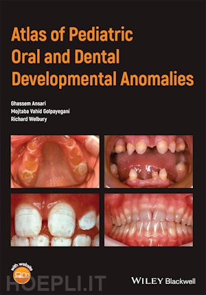 ansari g - atlas of pediatric oral and dental developmental anomalies