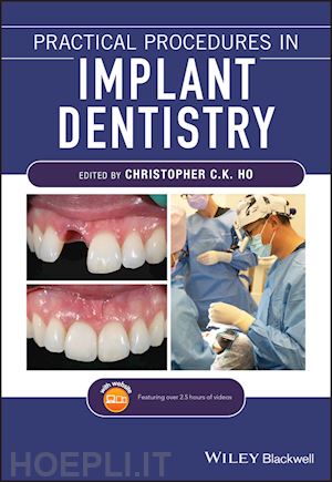 ho cck - practical procedures in implant dentistry