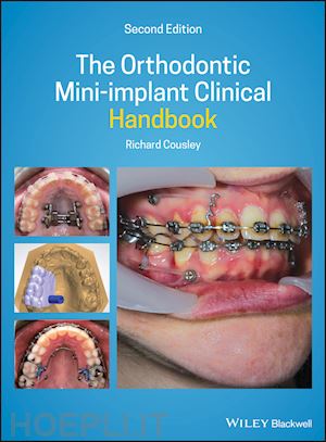 cousley r - the orthodontic mini–implant clinical handbook 2nd  edition