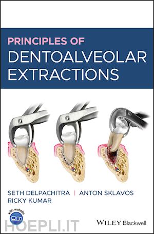 delpachitra s - principles of dentoalveolar extractions