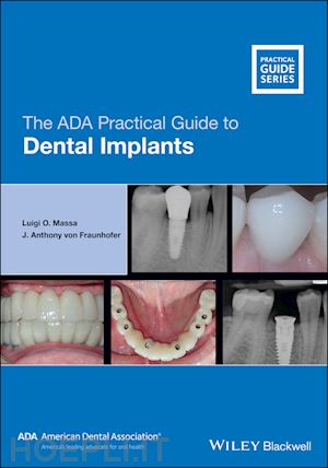 massa luigi o.; von fraunhofer j. anthony - the ada practical guide to dental implants