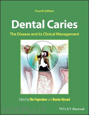 fejerskov o - dental caries – the disease and its clinical management 4th edition