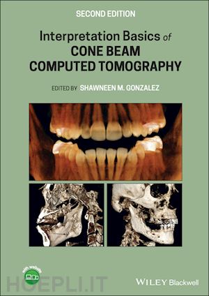 gonzalez shawneen m. (curatore) - interpretation basics of cone beam computed tomography