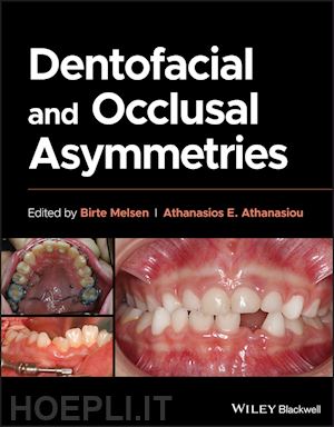 melsen b - dentofacial and occlusal asymmetries