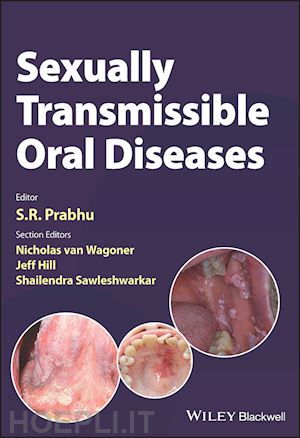 prabhu sr - sexually transmissible oral diseases