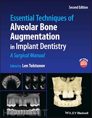 tolstunov len (curatore) - essential techniques of alveolar bone augmentation in implant dentistry