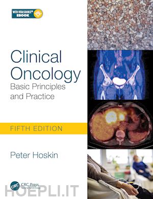 hoskin peter - clinical oncology