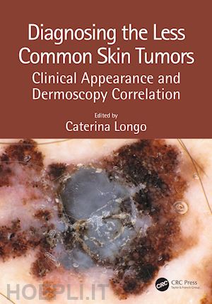 longo caterina (curatore) - diagnosing the less common skin tumors