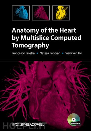 faletra f - anatomy of the heart by multislice computed tomography