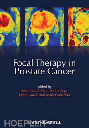 urology; hashim uddin ahmed; manit arya - focal therapy in prostate cancer