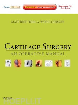 mats brittberg; wayne gersoff - cartilage surgery e-book