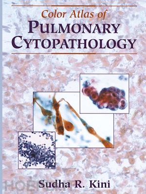 kini sudha r. - color atlas of pulmonary cytopathology