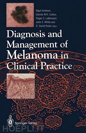 kirkham nigel (curatore); cotton dennis w.k. (curatore); lallemand roger c. (curatore); white john e. (curatore); rosin r. david (curatore) - diagnosis and management of melanoma in clinical practice